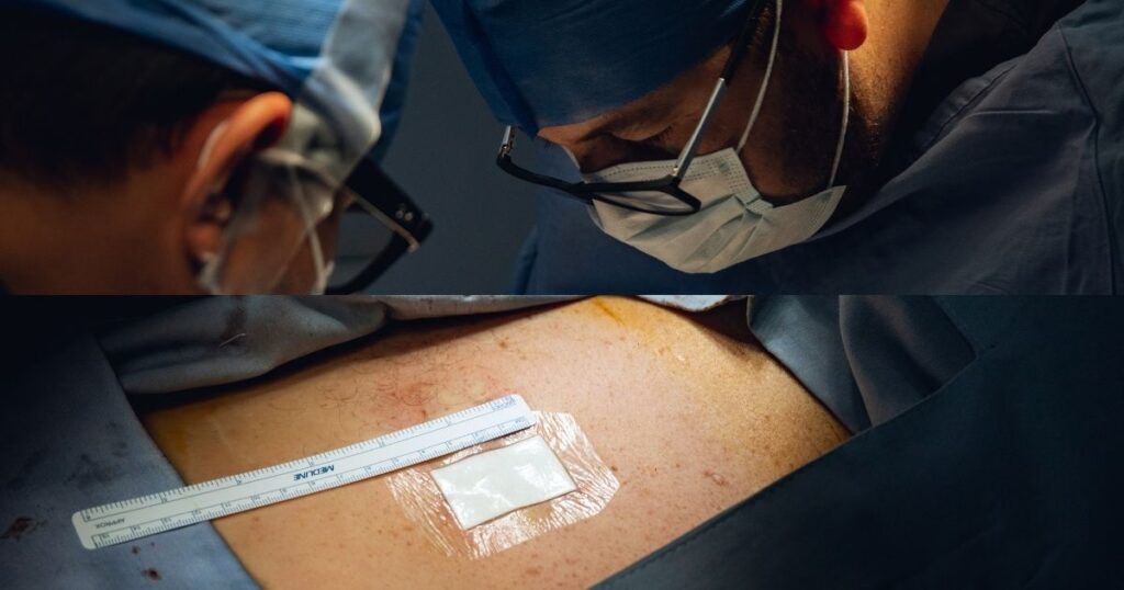 Cirugía de columna: