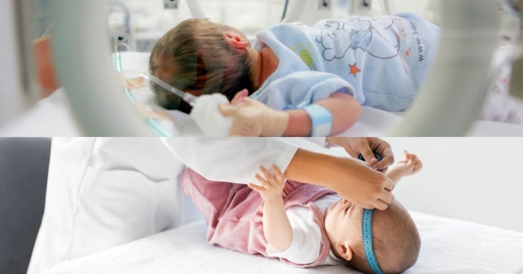 ¿La cabecita de tu bebé crece muy rápido?