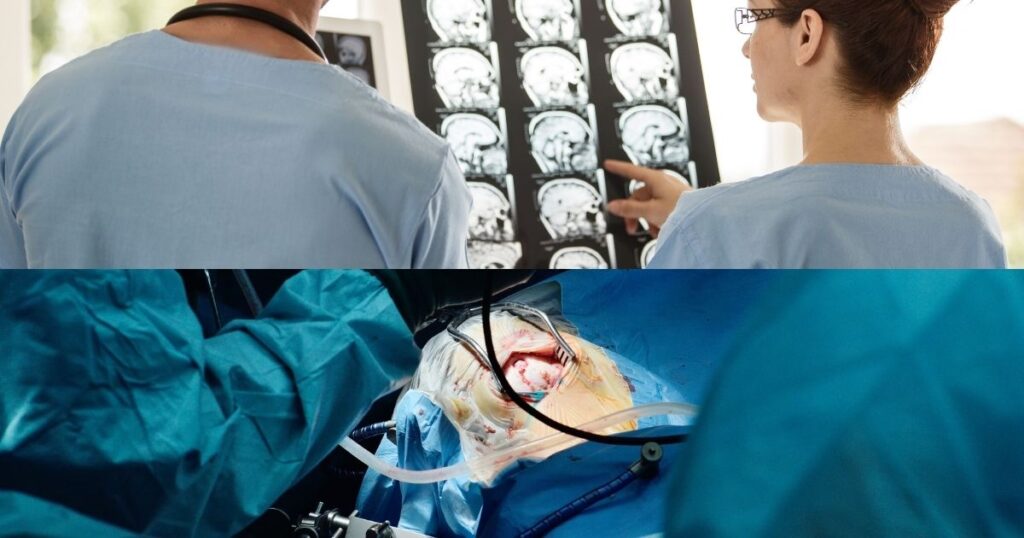 Cosas que debes saber si te diagnostican un tumor cerebral: